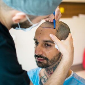 hair-transplant-turkiye hair-transplant-turkiye